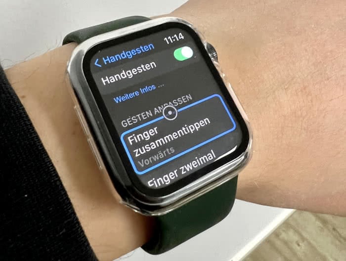 AssistiveTouch und Handgesten-Feature auf der Apple Watch